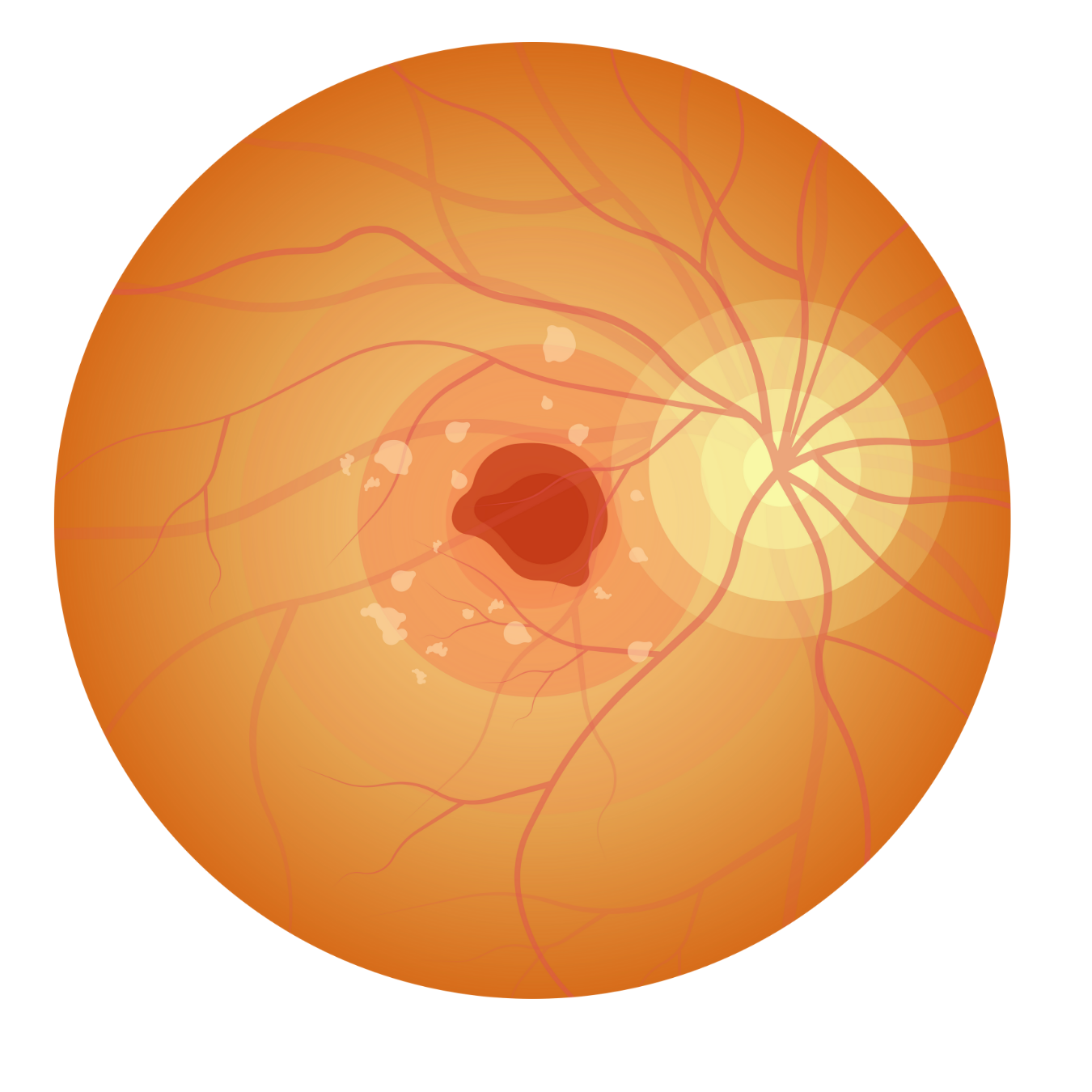 Canadian Ophthalmological Society marks AMD Awareness Month by highlighting advances in care and patient impact